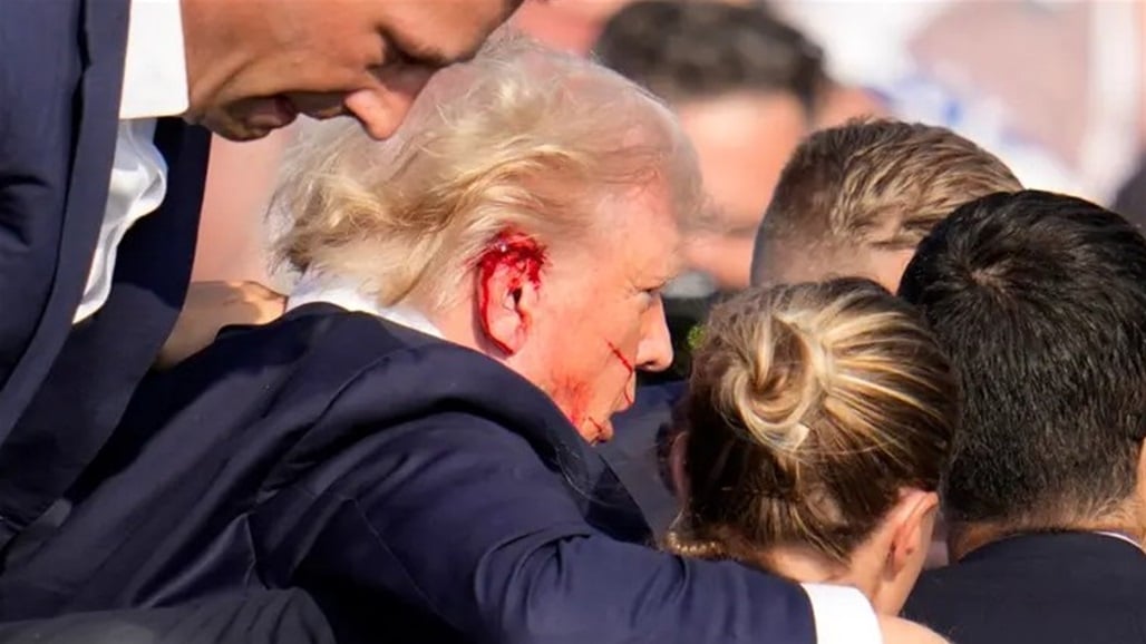 New details about Trump's injury after assassination attempt Doc-P-493771-638565322248162970