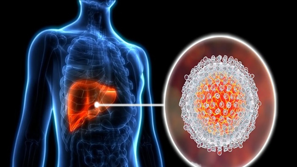في اليوم العالمي للالتهاب الكبدي.. تعرف على طرق الوقاية والعلاج